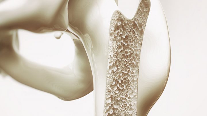 Bone Health Assessment Package <span class='pkgNo'>Pkg-09</span>