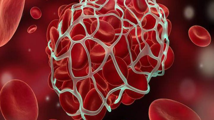 Disseminated Intravascular Coagulation Profile <span class='pkgNo'>Pkg-15</span>